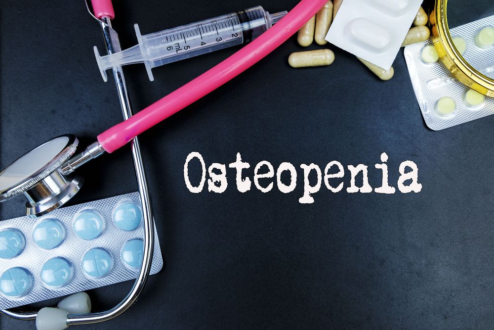 Modern Osteopenia Treatments: Hope Beyond Bisphosphonates