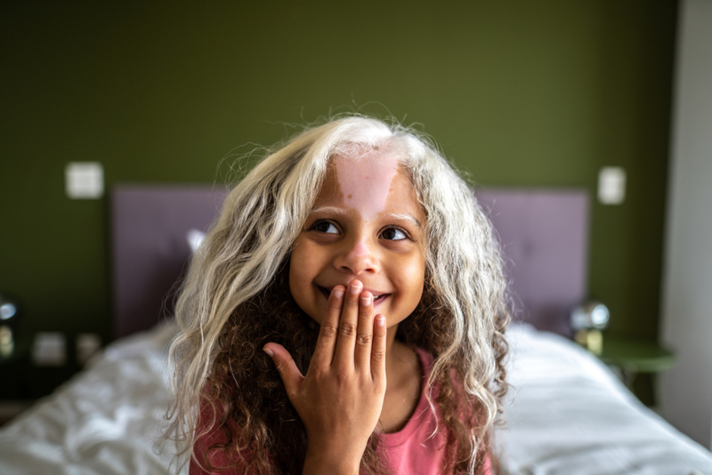 Ein Schopf weißes Haar  | Getty Images Photo by FG Trade