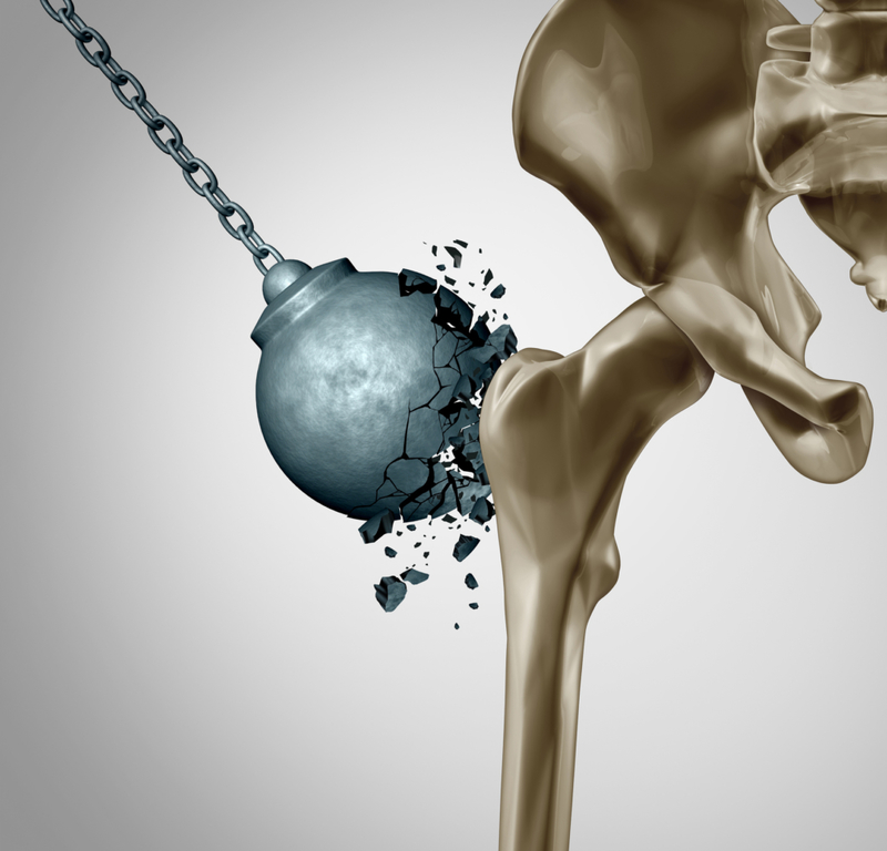 Das Gen das dir unzerbrechliche Knochen verleiht  | Getty Images Photo by wildpixel