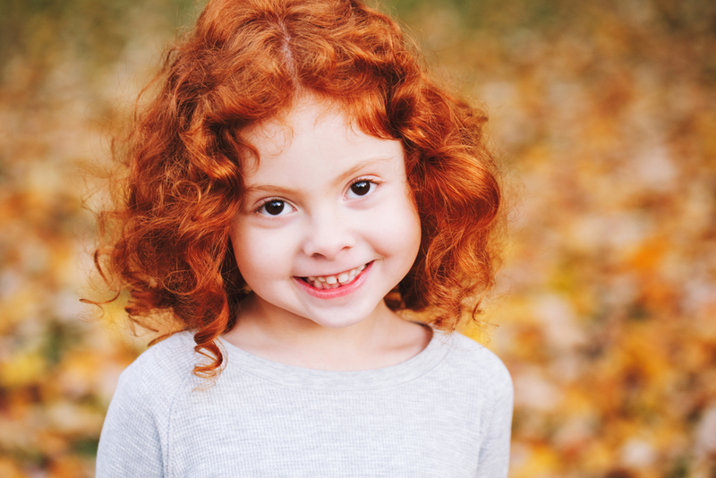 Der seltene genetische Zustand, bekannt als...rotes Haar | Shutterstock