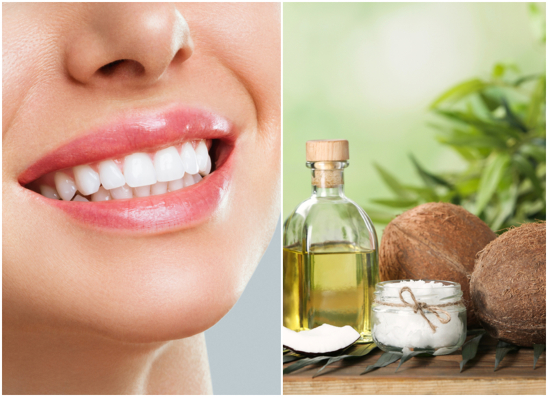 Kokosöl für gesunde Zähne | Shutterstock