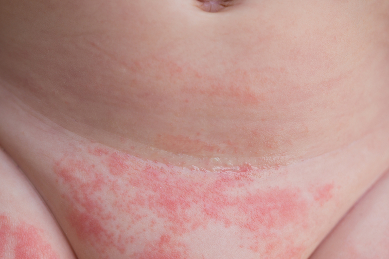 Hautausschlag von der Windel befreien | lavizzara/Shutterstock
